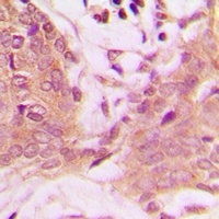 PEA15 (Phospho-S116) Rabbit Polyclonal Antibody