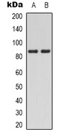 PI3K p85 alpha (Phospho-Y607) Rabbit Polyclonal Antibody