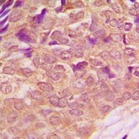 PI3K p85 alpha (Phospho-Y607) Rabbit Polyclonal Antibody