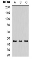 MKK1 (Phospho-T386) Rabbit Polyclonal Antibody
