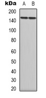 TRK B Rabbit Polyclonal Antibody
