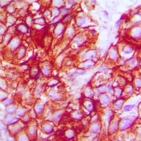 TRK B Rabbit Polyclonal Antibody