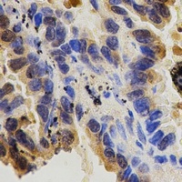 CD29 Rabbit Polyclonal Antibody