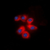 CD29 Rabbit Polyclonal Antibody