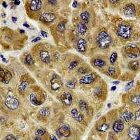c-RAF Rabbit Polyclonal Antibody
