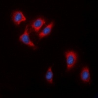 c-RAF Rabbit Polyclonal Antibody