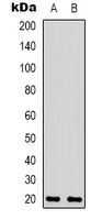 BAX Rabbit Polyclonal Antibody