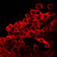 BAX Rabbit Polyclonal Antibody