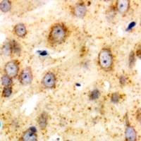 CD226 Rabbit Polyclonal Antibody