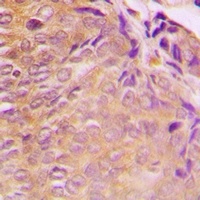 GRB10 Rabbit Polyclonal Antibody
