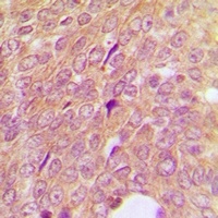 IGFBP3 Rabbit Polyclonal Antibody