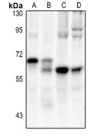 CD127 Rabbit Polyclonal Antibody