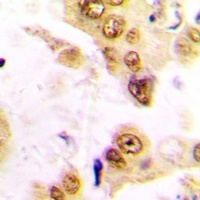 SRF Rabbit Polyclonal Antibody