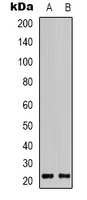 Claudin 7 Rabbit Polyclonal Antibody