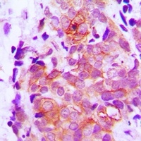 Claudin 7 Rabbit Polyclonal Antibody