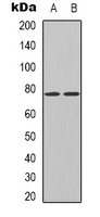 hnRNP M Rabbit Polyclonal Antibody