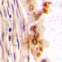 hnRNP M Rabbit Polyclonal Antibody