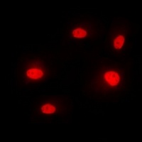 hnRNP M Rabbit Polyclonal Antibody