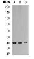 CAR Rabbit Polyclonal Antibody
