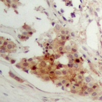 CAR Rabbit Polyclonal Antibody