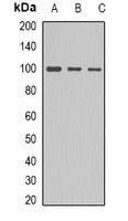 ACTN1 Rabbit Polyclonal Antibody