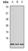 RPS20 Rabbit Polyclonal Antibody