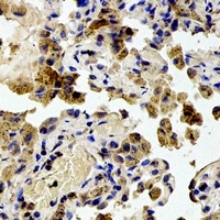 RPS20 Rabbit Polyclonal Antibody