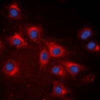 RPS20 Rabbit Polyclonal Antibody