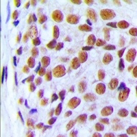 PRPF6 Rabbit Polyclonal Antibody