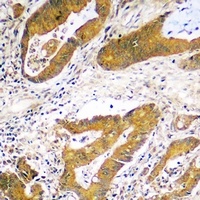 USP48 Rabbit Polyclonal Antibody
