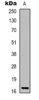 Histone H3 (DiMethyl-K27) Rabbit Polyclonal Antibody