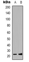 FGF12 Rabbit Polyclonal Antibody