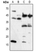 VEGFA Rabbit Polyclonal Antibody