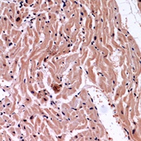 VEGFA Rabbit Polyclonal Antibody