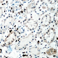 Tenascin C Rabbit Polyclonal Antibody