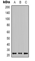 KRAS Rabbit Polyclonal Antibody