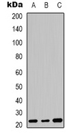 FGF20 Rabbit Polyclonal Antibody