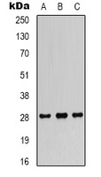 FGF18 Rabbit Polyclonal Antibody