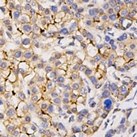 CD133 Rabbit Polyclonal Antibody