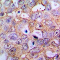 IL-1 beta Rabbit Polyclonal Antibody