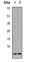 CCL11 Rabbit Polyclonal Antibody
