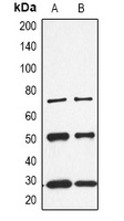 CALB1 Rabbit Polyclonal Antibody