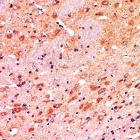 CALB1 Rabbit Polyclonal Antibody