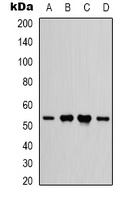 IFNGR1 Rabbit Polyclonal Antibody
