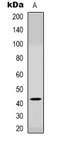 CCR6 Rabbit Polyclonal Antibody