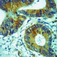 CCR6 Rabbit Polyclonal Antibody