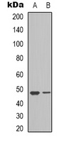VEGFC Rabbit Polyclonal Antibody