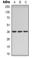CER1 Rabbit Polyclonal Antibody