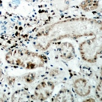 CER1 Rabbit Polyclonal Antibody