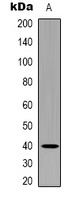 TGF beta 4 Rabbit Polyclonal Antibody